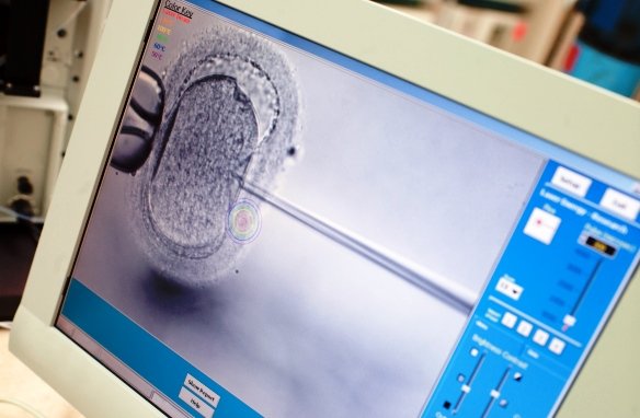 Sokszor indokolatlan kockázat a lombikbébi (Fotó: Europress) Sokszor indokolatlan kockázat a lombikbébi (Fotó: Europress)